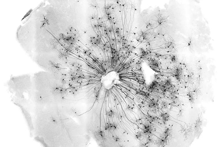 retinal ganglion cells