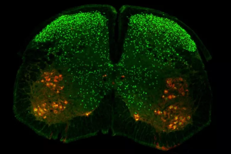 spinal cord