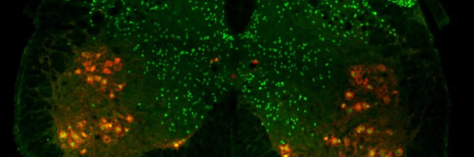 spinal cord banner